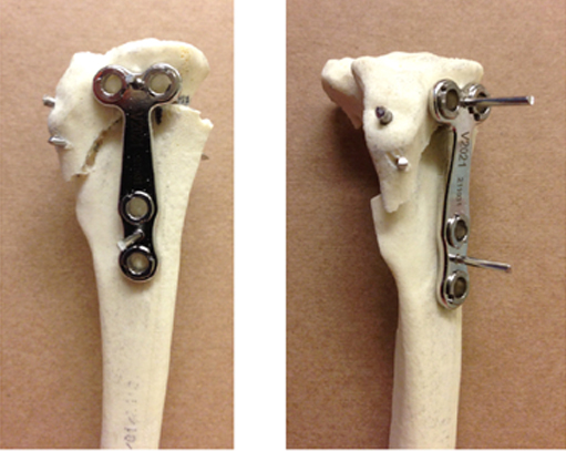 水平化骨きり術01