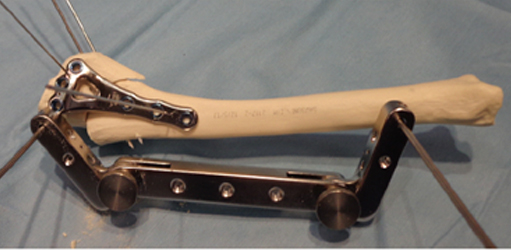 水平化骨きり術02