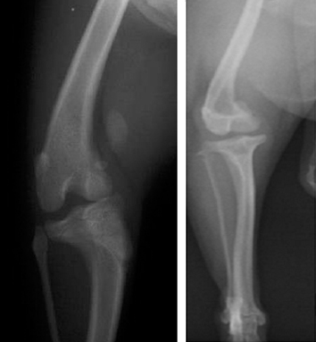 膝蓋骨支持縫合