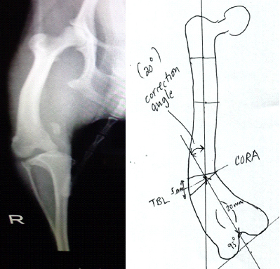 膝蓋骨内側の脱臼(グレード4)の手術計画行程表