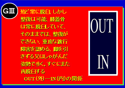 膝蓋骨脱臼のグレード分け G3
